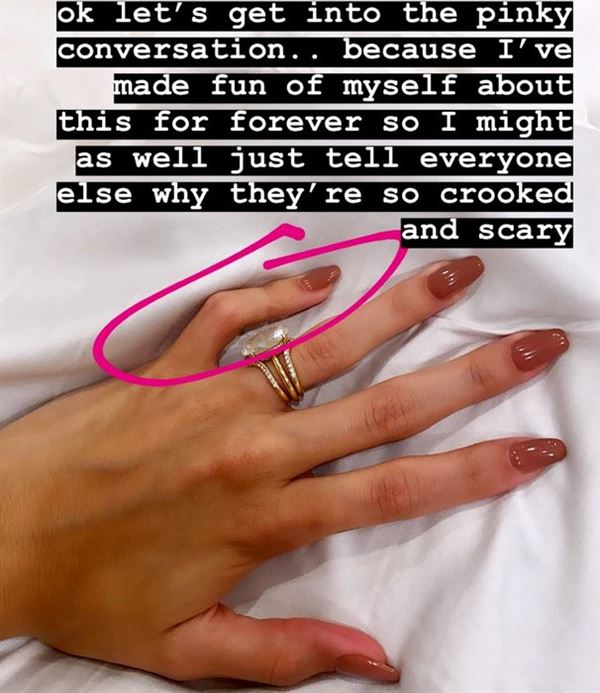 Жена Бибера раскрыла секрет скрюченного пальца